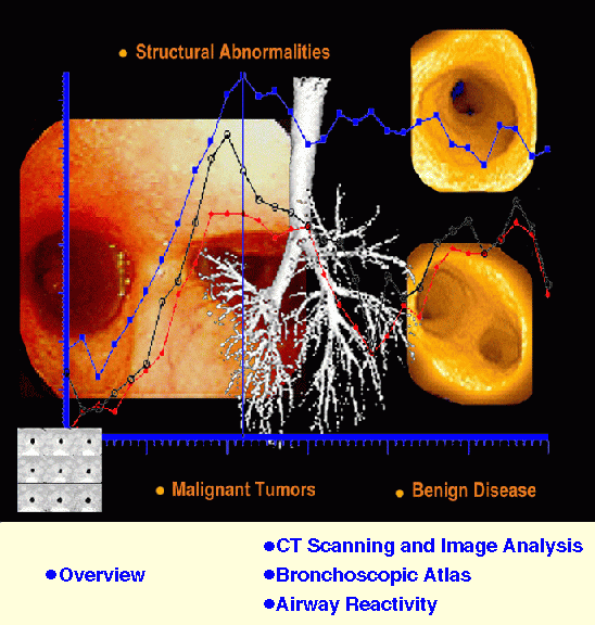 bronchoscopy.gif