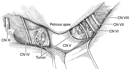 cranial_ns_100dpi.jpg