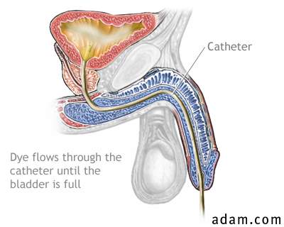 cystography9252.jpg