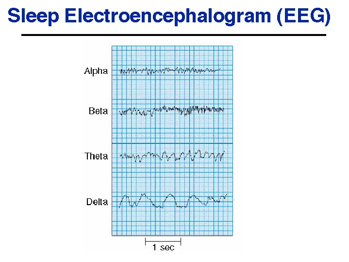 encephalogramimg011.jpg