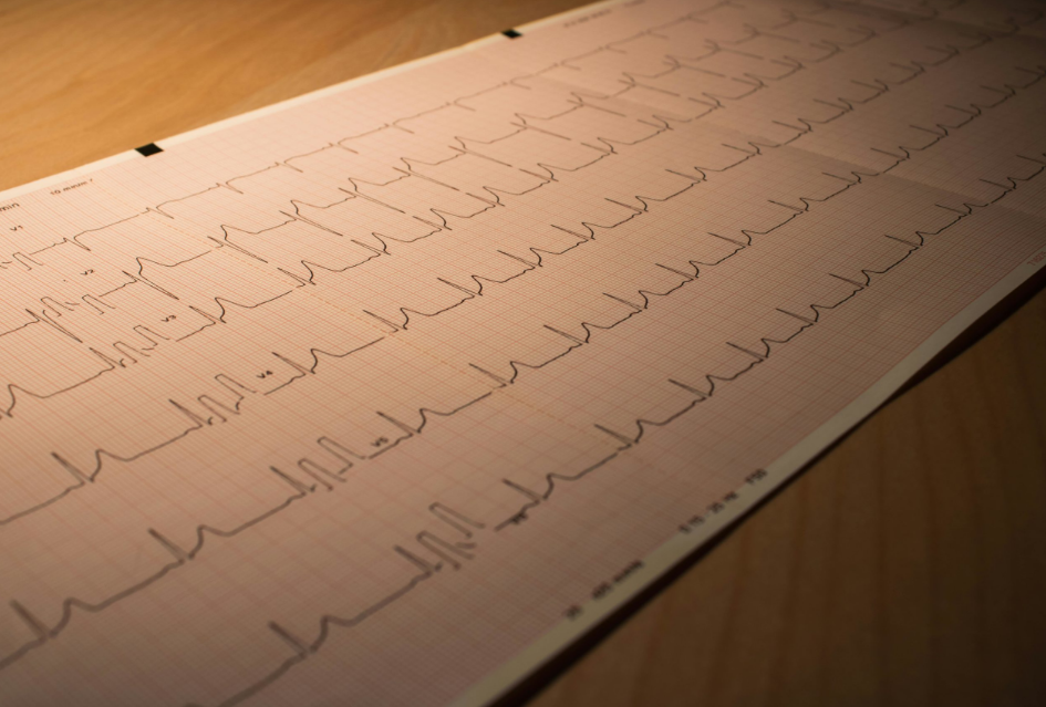 resource image of an electrocardiogram